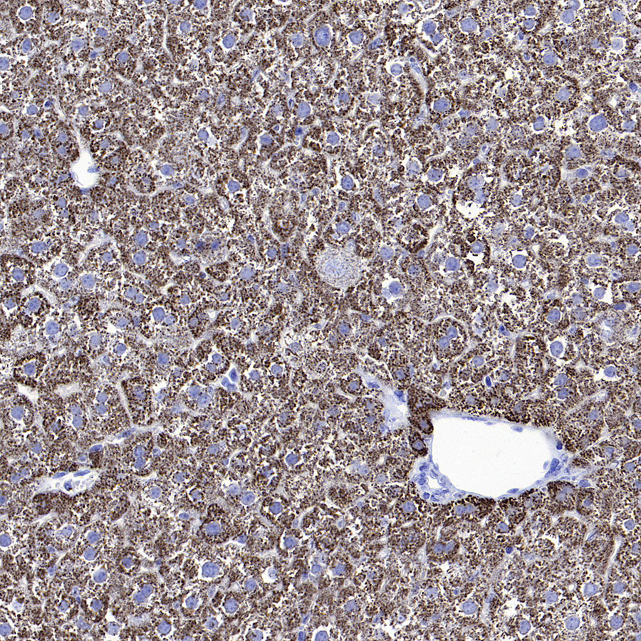Hepatocyte Specific Antigen Recombinant Mouse mAb (SDT-4389)