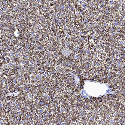 Hepatocyte Specific Antigen Recombinant Mouse mAb (SDT-4389)