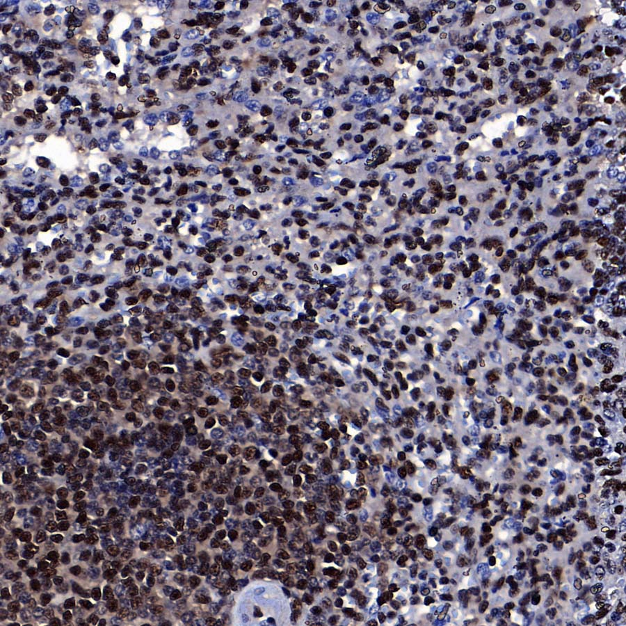 RPA3 Recombinant Rabbit mAb (S-4552-20)