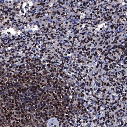 RPA3 Recombinant Rabbit mAb (S-4552-20)