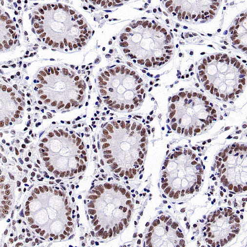 TEL1 Recombinant Rabbit mAb (S-3067-60)