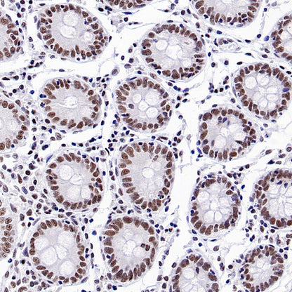 TEL1 Recombinant Rabbit mAb (S-3067-60)