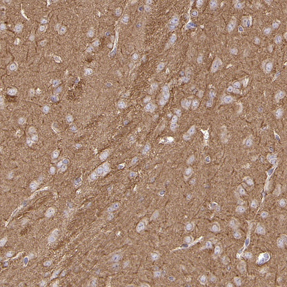 α/β-Tubulin Antibody Rabbit Polyclonal Antibody