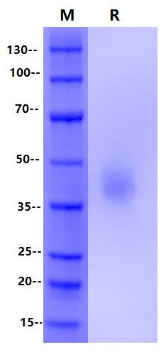B7-H3/CD276 His Tag Protein, Human
