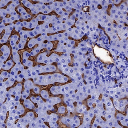 CD36 Recombinant Rabbit mAb,PBS Only (SDT-358-19)