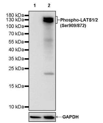 Phospho-LATS1/2(Ser909/872) Recombinant Rabbit mAb (S-1874-69)