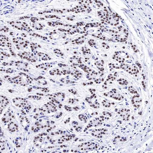 TRPS1 Recombinant Rabbit mAb (S-765-3)