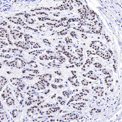TRPS1 Recombinant Rabbit mAb (S-765-3)
