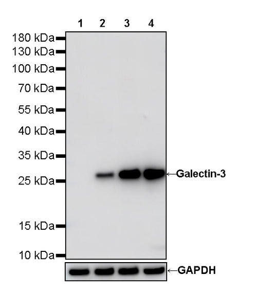 Galectin-3 Recombinant Rabbit mAb (SDT-370-111)