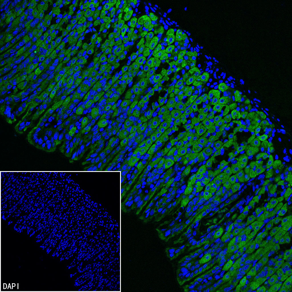 CHCHD10 Recombinant Rabbit mAb (S-4106-13)