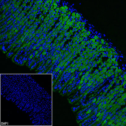 CHCHD10 Recombinant Rabbit mAb (S-4106-13)