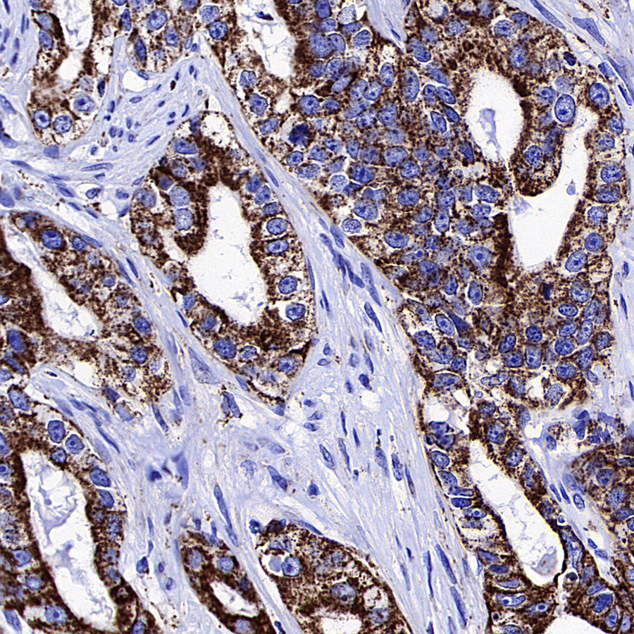 ATPIF1 Recombinant Rabbit mAb (S-3849-49)