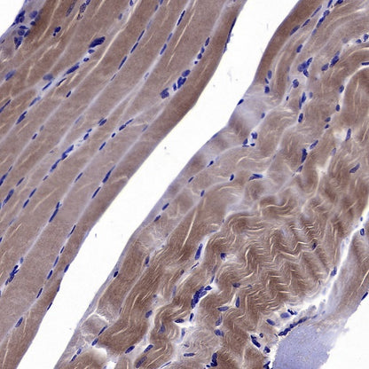 GABARAP Recombinant Rabbit mAb (S-2372-47)