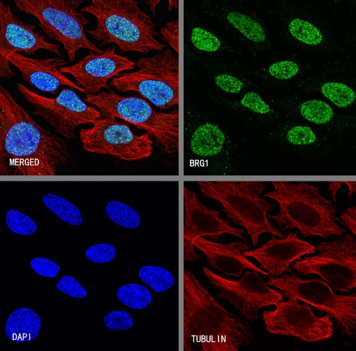 BRG1 Recombinant Rabbit mAb (S-1513-4)