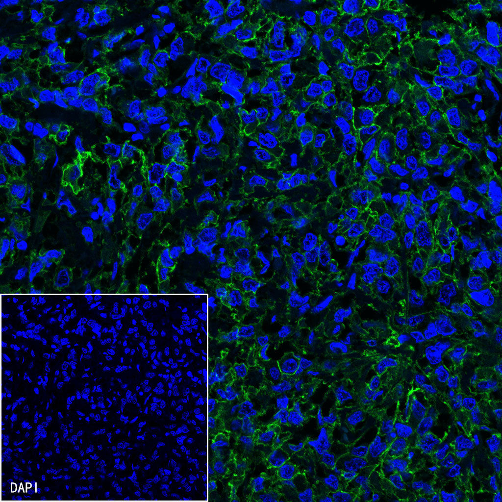 S-RMab® ErbB2 Recombinant Rabbit mAb (SDT-069-57)