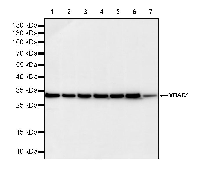 VDAC1 Recombinant Rabbit mAb (S-5314)