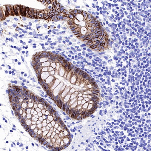 Claudin 4 Recombinant Rabbit mAb (SDT-814-53)