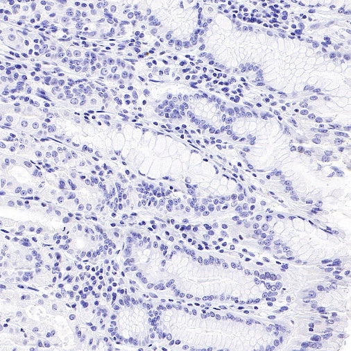 CD44v6 Mouse mAb (S-945-76)