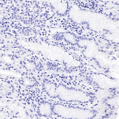 CD44v6 Mouse mAb (S-945-76)