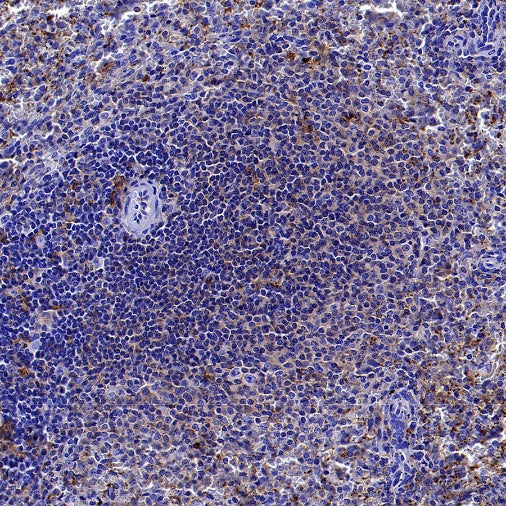 CMTM6 Recombinant Rabbit mAb (S-2013-4)
