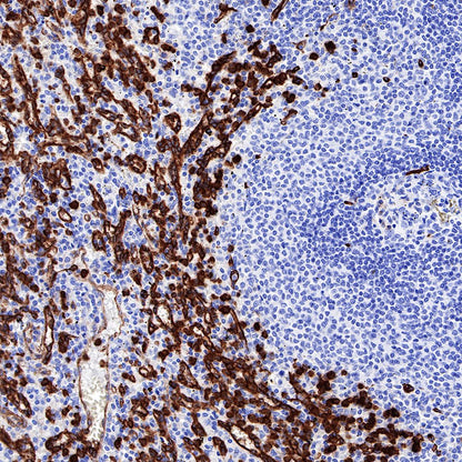 Caveolin-1 Recombinant Rabbit mAb (SDT-065-20)
