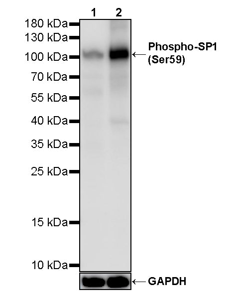 Phospho-SP1 (Ser59) Recombinant Rabbit mAb (S-3714-13)