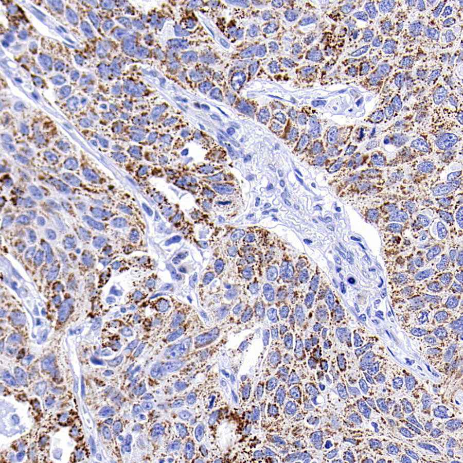 Aass Recombinant Rabbit mAb (S-4170-22)