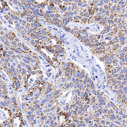 Aass Recombinant Rabbit mAb (S-4170-22)