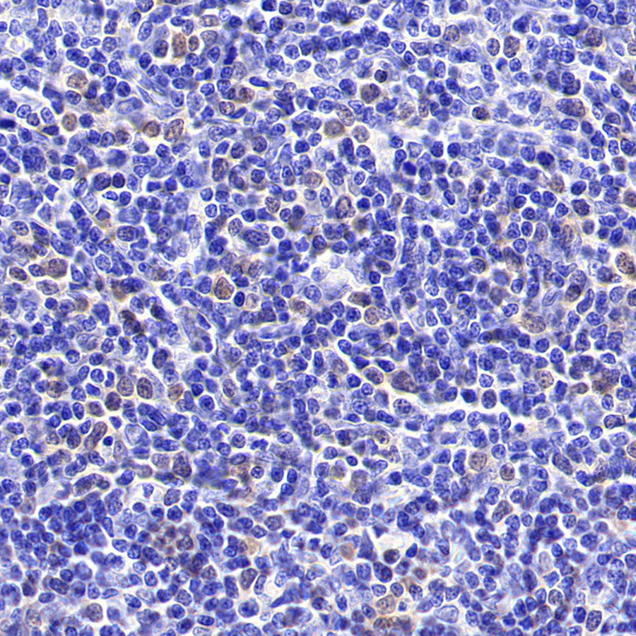Chk1 Recombinant Mouse mAb (S-6263)