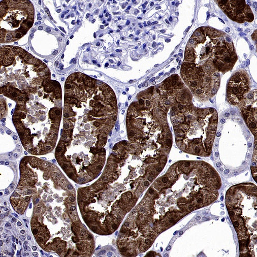 SREBP2 Recombinant Rabbit mAb (S-2701-1)
