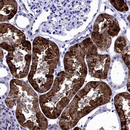SREBP2 Recombinant Rabbit mAb (S-2701-1)