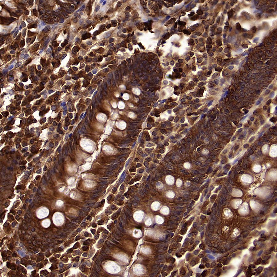 Aldolase A Recombinant Rabbit mAb (S-4007-23)