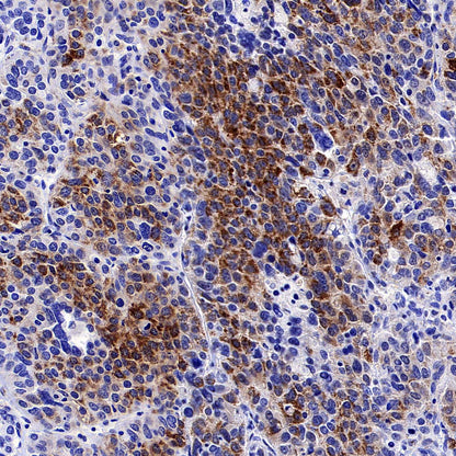 CHCHD10 Recombinant Rabbit mAb (S-4106-13)