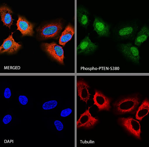 Phospho-PTEN (S380) Recombinant Rabbit mAb (S-1165-163)
