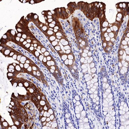 TRIM29 Recombinant Rabbit mAb (S-642-43)