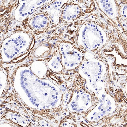 PTRF Recombinant Rabbit mAb (S-3271-13)