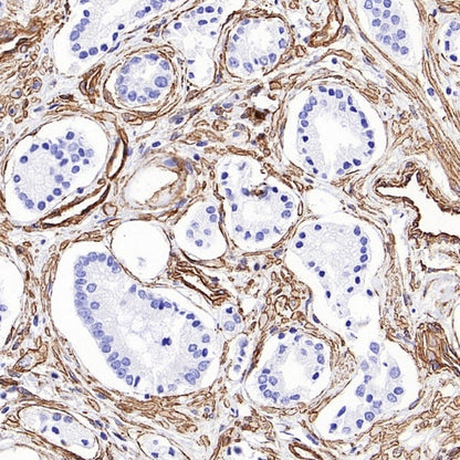 PTRF Recombinant Rabbit mAb (S-3271-13)