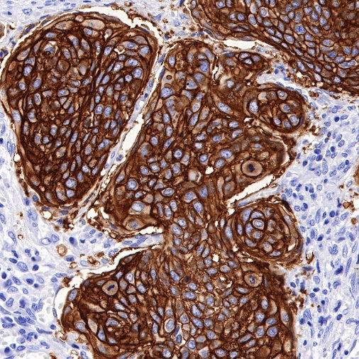 TACSTD2/TROP2 Recombinant Rabbit mAb (S-R237)
