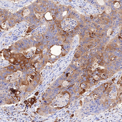 Ezrin Recombinant Rabbit mAb (S-R358)