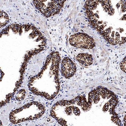 VDAC1 Recombinant Rabbit mAb (S-1877-18)