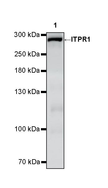ITPR1 Recombinant Rabbit mAb (S-4530-5)