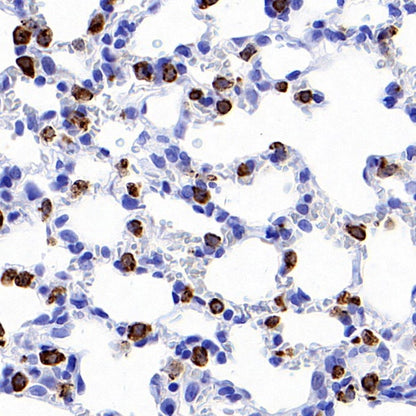 Prosurfactant Protein C Recombinant Rabbit mAb (S-1773-6)