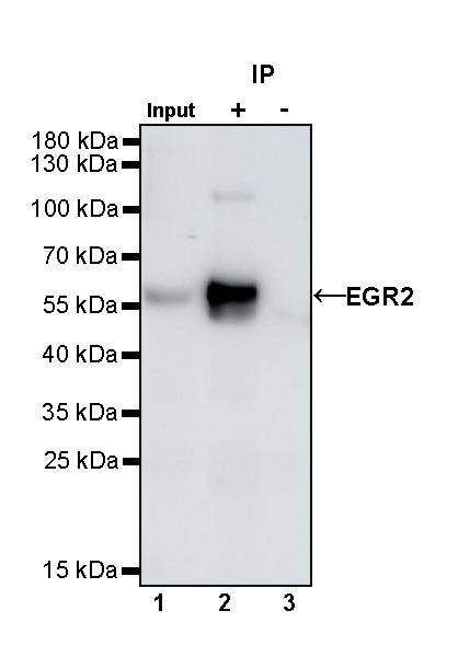 EGR2 Recombinant Rabbit mAb (S-741-136)