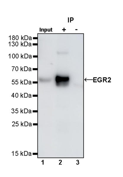 EGR2 Recombinant Rabbit mAb (S-741-136)