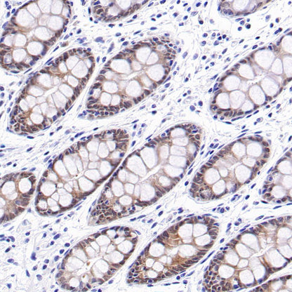 4E-BP1 Recombinant Rabbit mAb (S-1654-47)