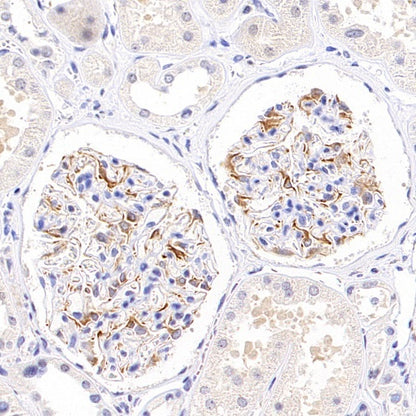 Phospho-Vimentin (Ser39) Rabbit Polyclonal Antibody