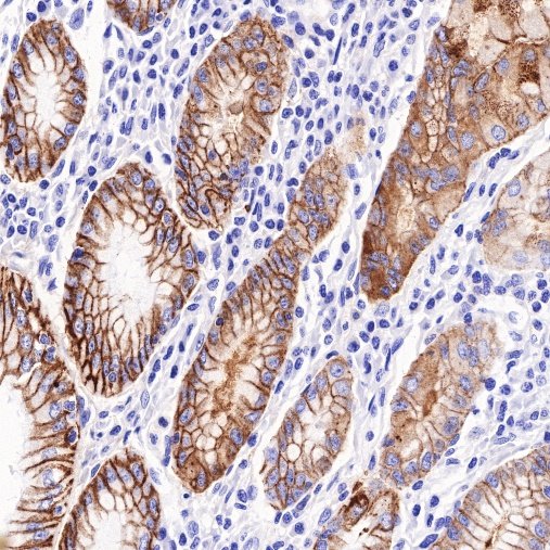 Antibody Diluent