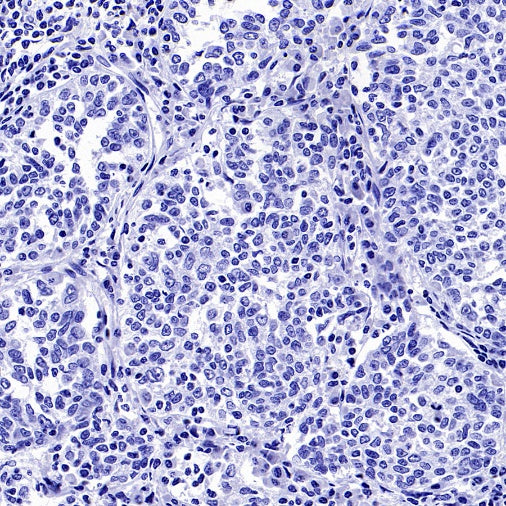 SEZ6 Recombinant Rabbit mAb (SDT-2097-737)