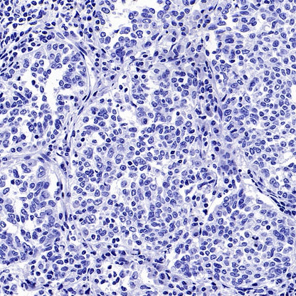 SEZ6 Recombinant Rabbit mAb (SDT-2097-737)