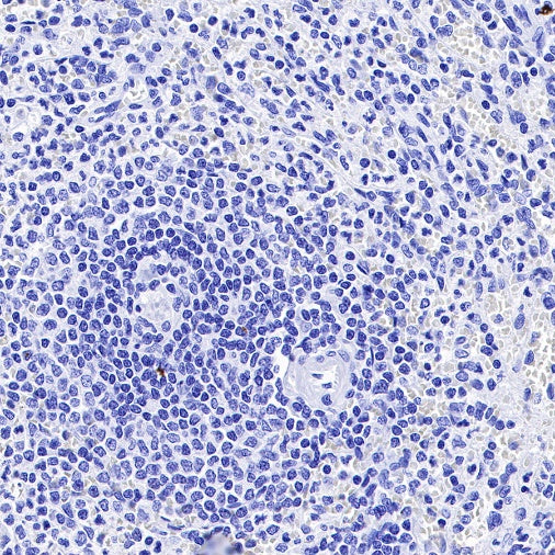 S-RMab® CGA/HCG-α Recombinant Rabbit mAb (SDT-643-61)